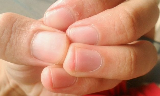 The Best Ever Adaptive Dementia Eating Utensils